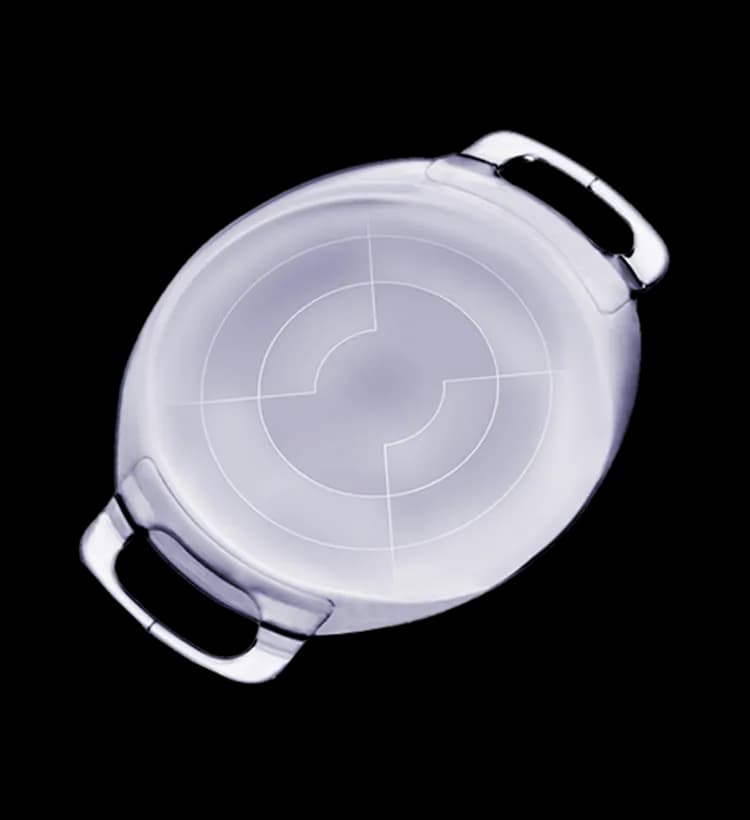 ArtiPlus implantable lens