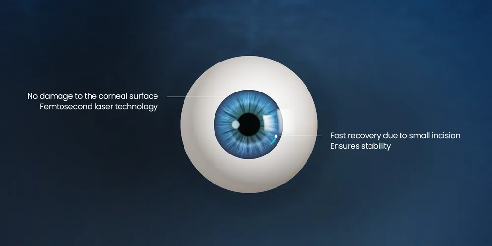 Eye diagram with callouts: femtosecond laser, no damage to the corneal surface, small incision